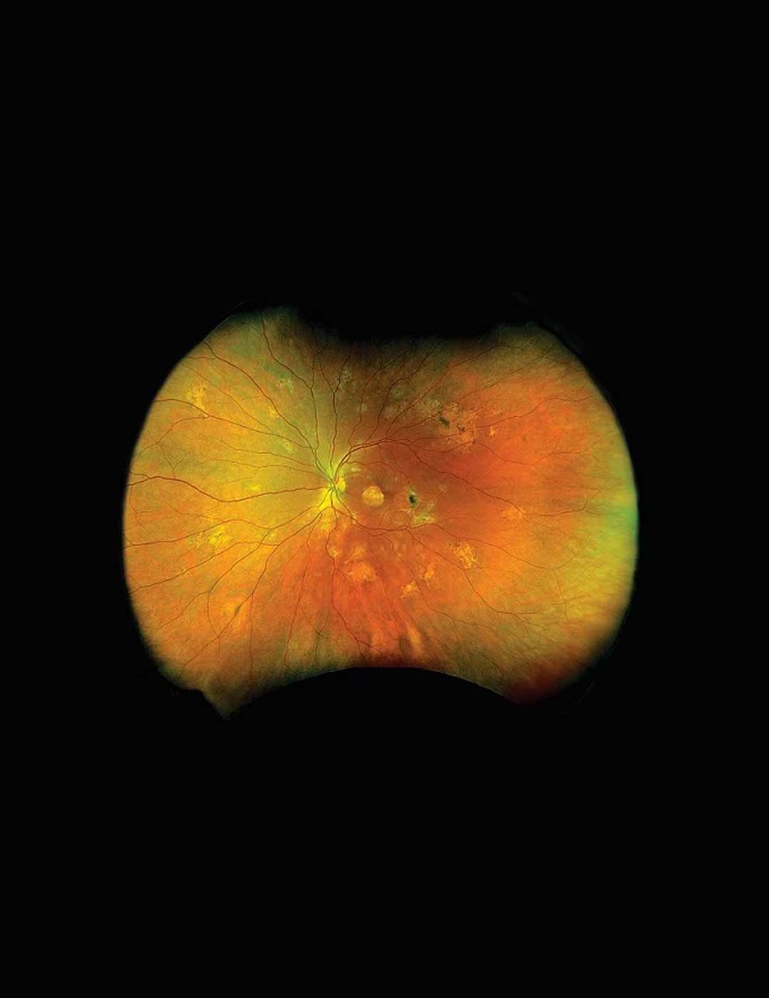 Example of an Optomap scan
